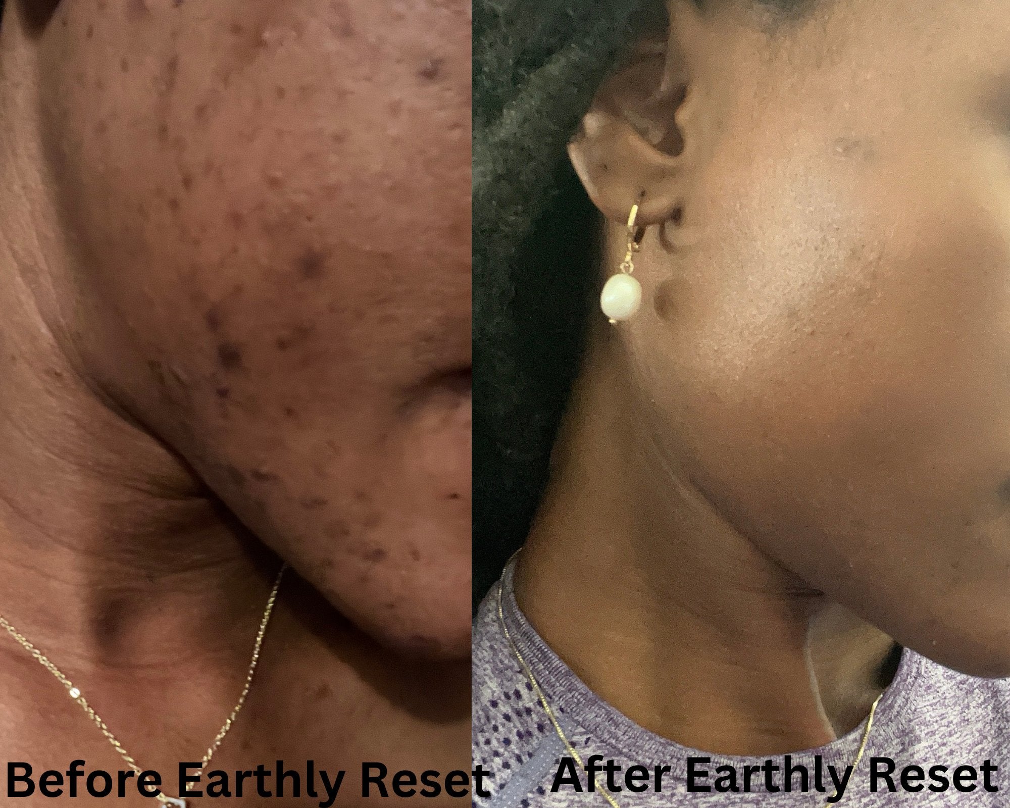 Eartlyreset_Before_after_coaching 1
